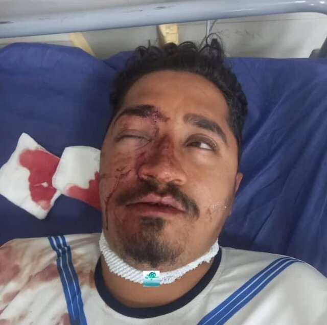 قهرمانی جام حذفی به چه قیمتی؟ | تلاش پزشکان برای عدم تخلیه چشم هوادار ملوان!