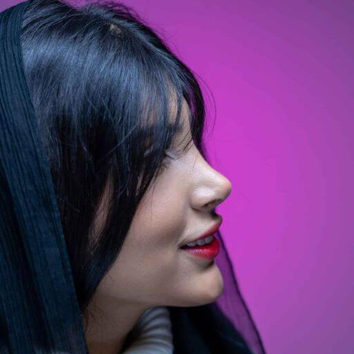 قوس بینی بعد از عمل