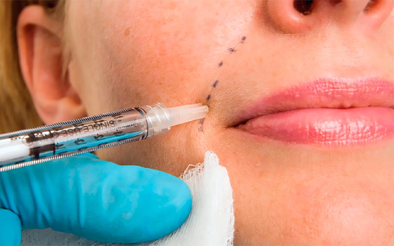 تزریق ژل برای چه کسانی ممنوع است؟